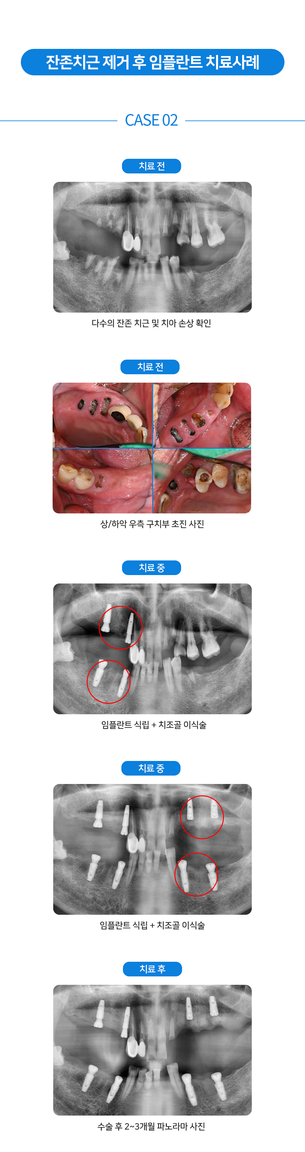 치료전후 2