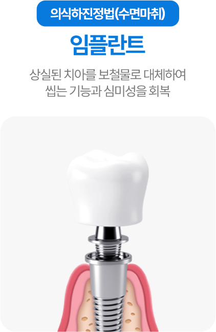 의식하진정법(수면마취) 임플란트