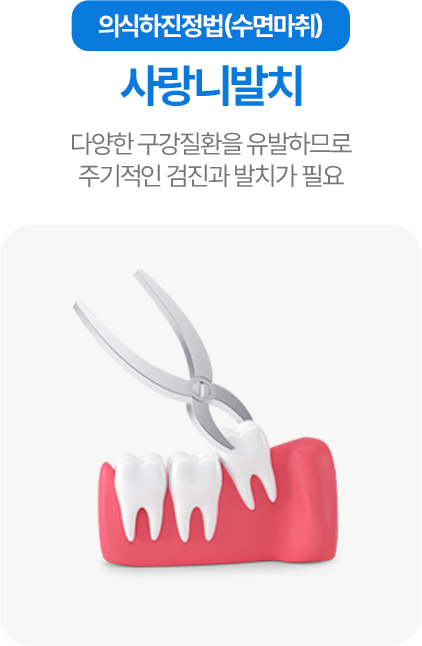 의식하진정법(수면마취) 사랑니발치