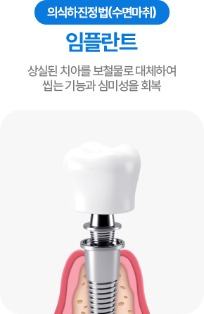 의식하진정법(수면마취) 임플란트