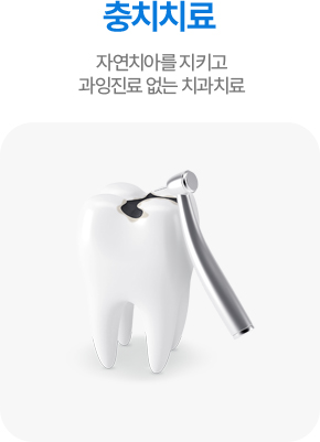 충치치료