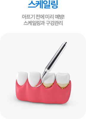스케일링
